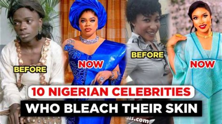 Celebs Who Bleached Their Skin And The Impact